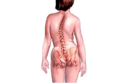 The causes of the development of cervical osteocondrosis