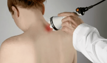 Treatment of cervical osteocondrosis by physiotherapy