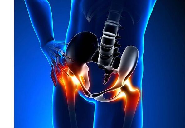 Pain for Cookes arthritis
